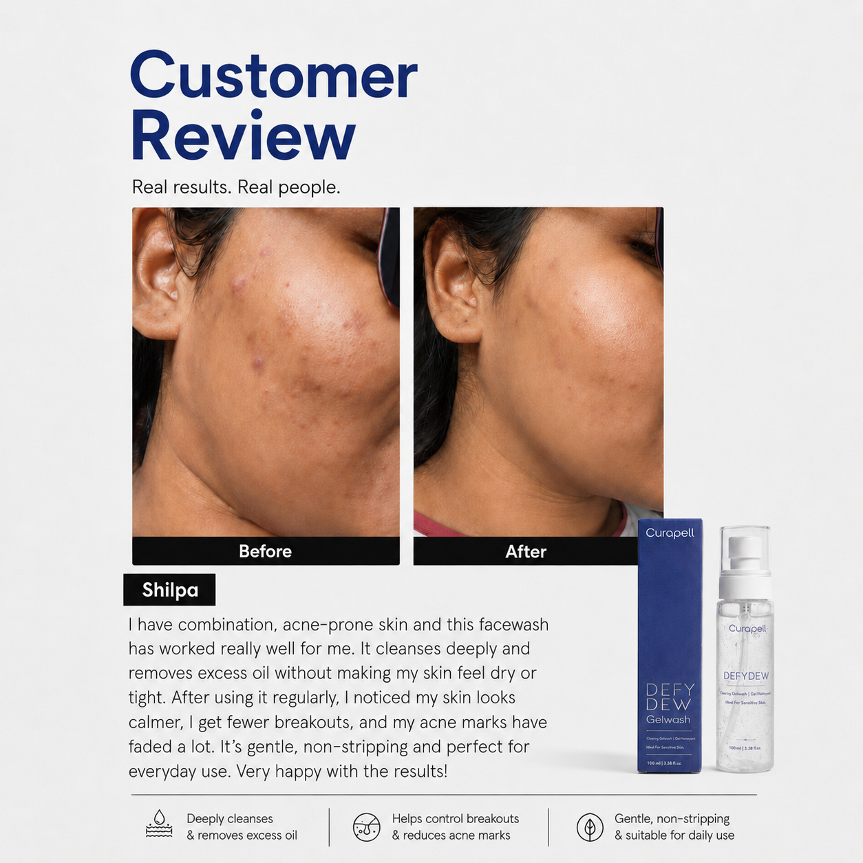 Curapell Gentle Skin Cleanser